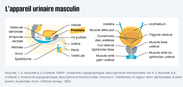 Adénome de la prostate