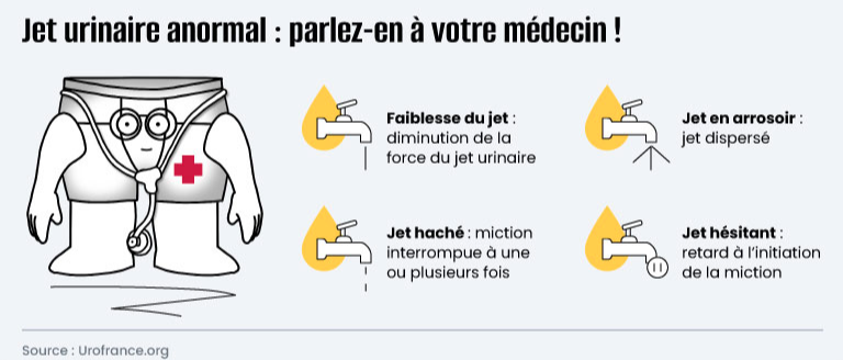 Infographie jet urinaire