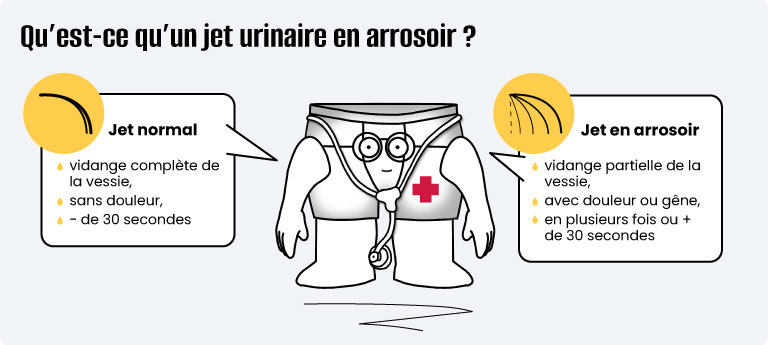Infographie jet urinaire