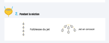Mieux comprendre la miction par poussée chez l’homme