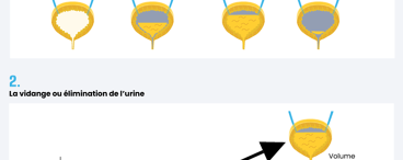Que faire en cas de rétention urinaire liée à l’âge ?