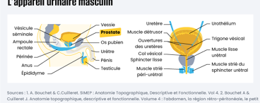 Gonflement ou augmentation du volume de la prostate  